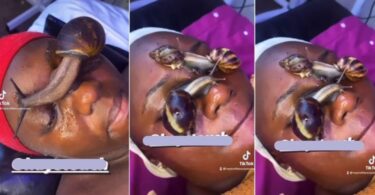 “What type of therapy is this” – Video of live snails crawling on lady’s face sparks outrage (Watch)